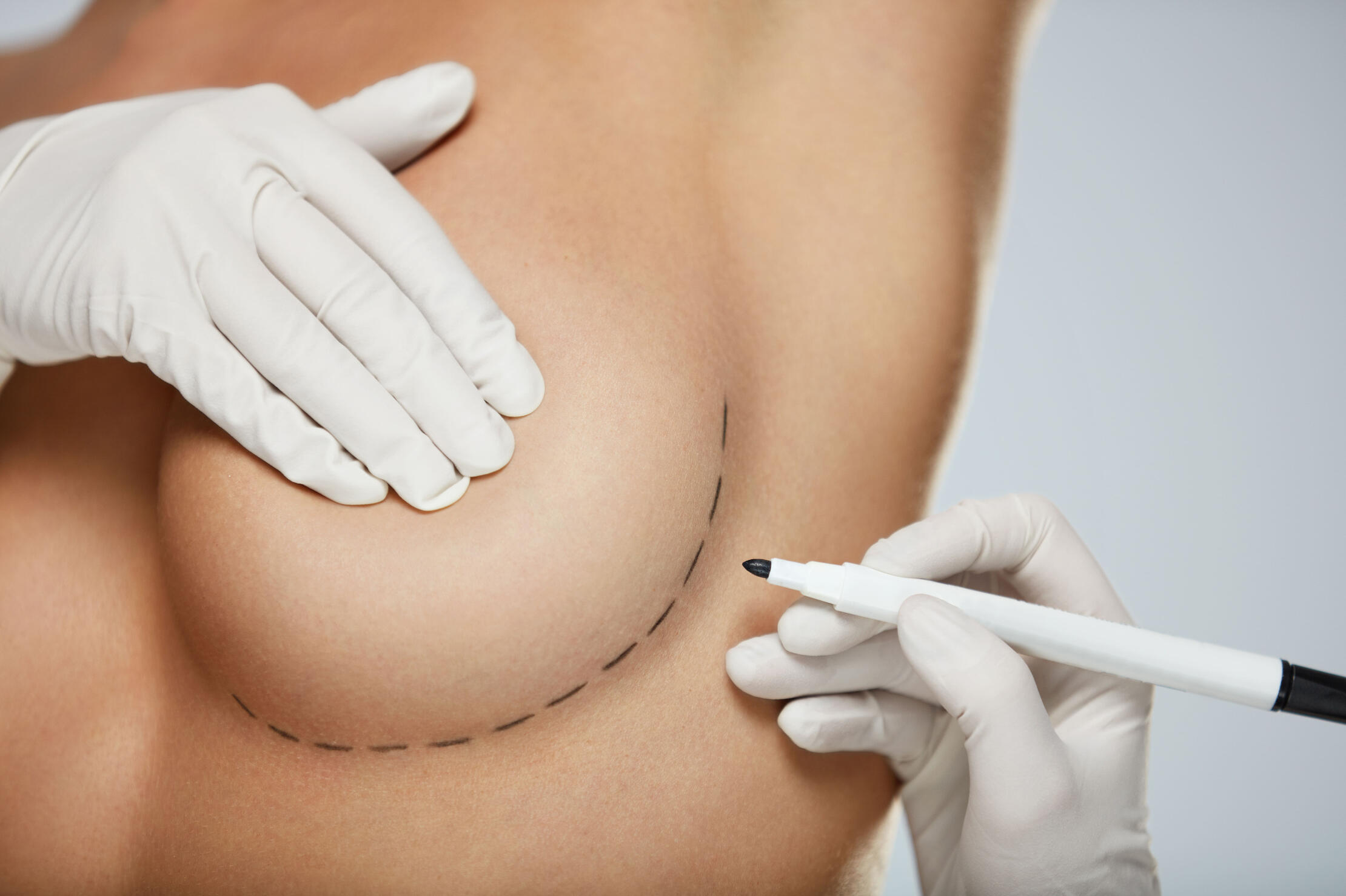 Mississippi Mommy Makeover Surgery